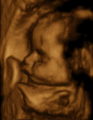 Snímky miminek z 3D/4D ultrazvuku