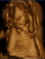 Snímky miminek z 3D/4D ultrazvuku